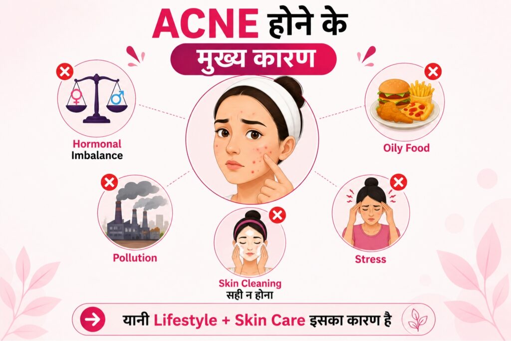 Acne Pimples Kya Hote Hai Karan Lakshan Ayurveda Upar
