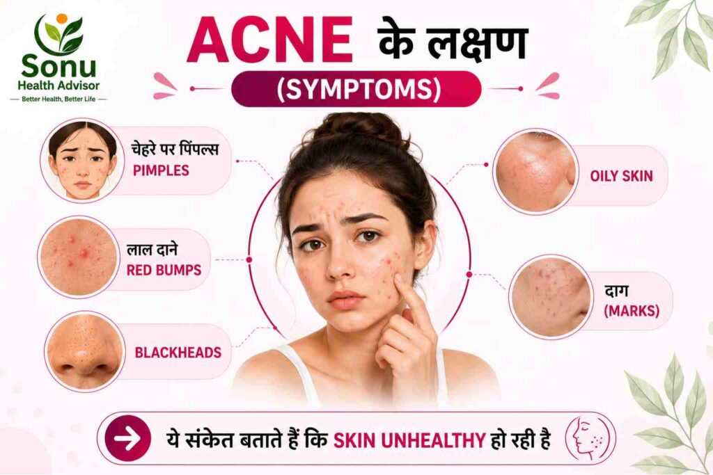 Acne Pimples Kya Hote Hai Karan Lakshan Ayurveda Upar