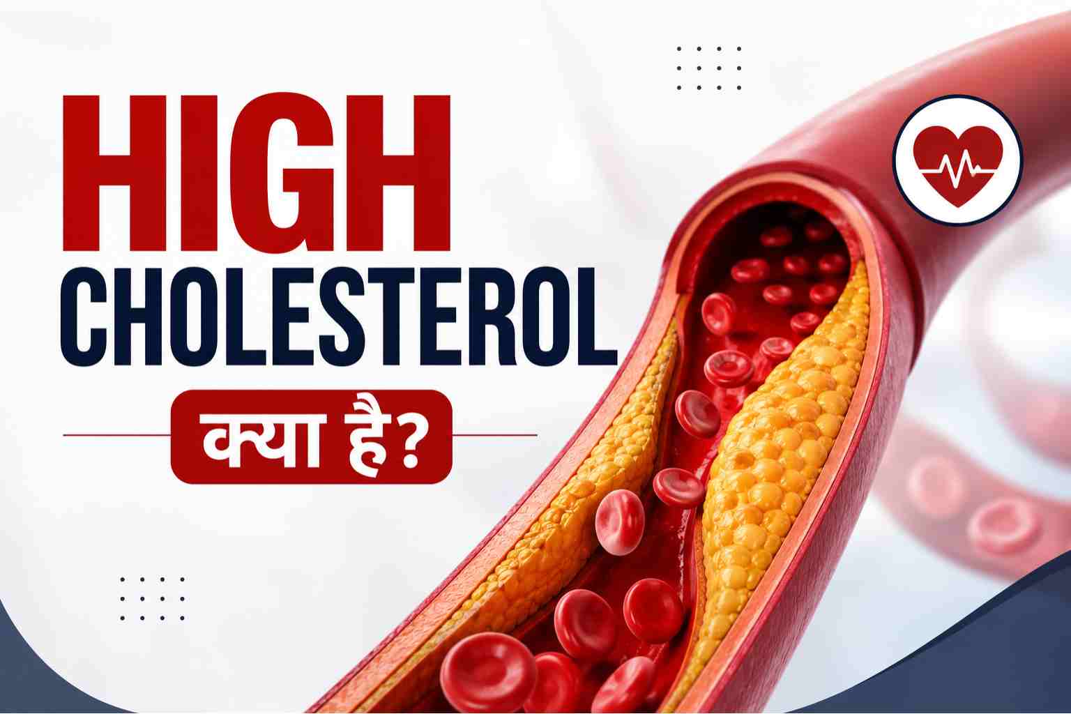 High Cholesterol Kya Hai Karan Lakshan Ayurveda Upay